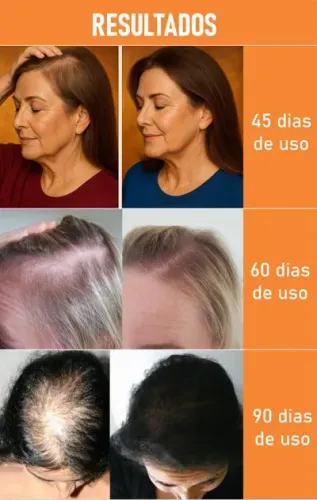 ATIVADOR DE CRESCIMENTO PRO+
