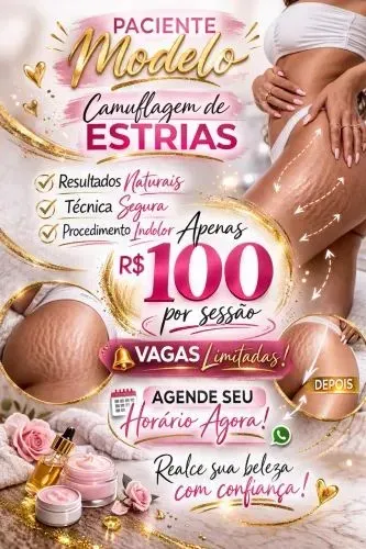 Camuflagem de estrias , catrizes , vitiligo