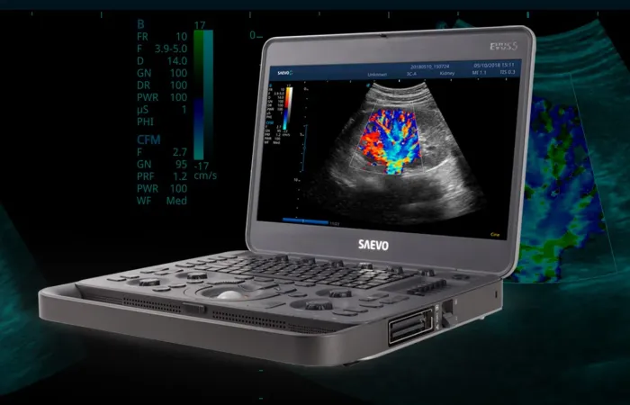 Ultrassom com Doppler SAEVO EVUS 5 Completo