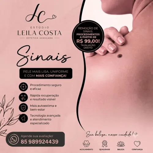 Remoção de sinal