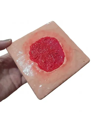 Simulador de feridas (tecido em granulação))