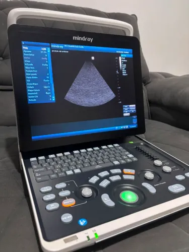 Ultrassom Mindray Z60 2022