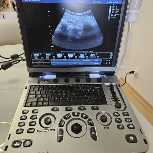 Ultrassom Ebit 30 Chison