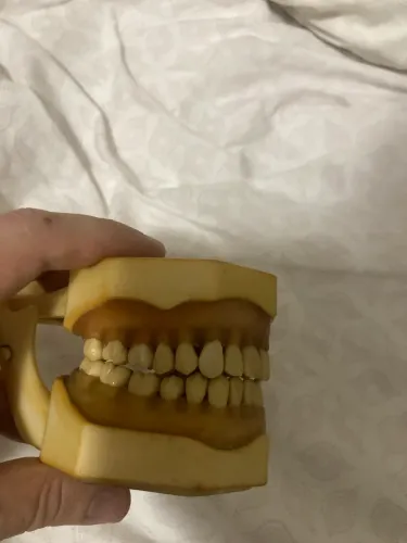 Macromodelo Odontologia Periodontia Dentística Prótese