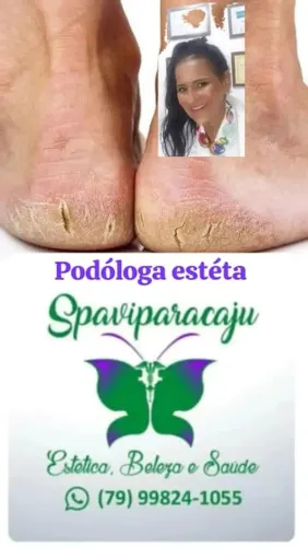 Podólogia sem dores! Graduada e pós graduada. 