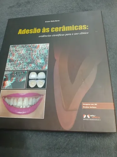 Livro de odontologia " Adesão as Cerâmicas"