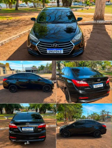 Hyundai HB20S Premium 1.6 Flex 16V Aut. 4P 2018