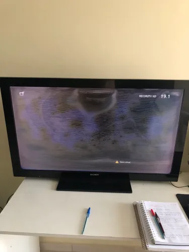 Tv Sony (problema na imagem)