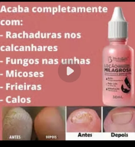 Gota milagrosa para os pés 30ML