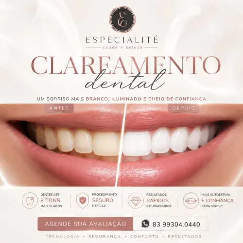 Clareamento Dental em João Pessoa 
