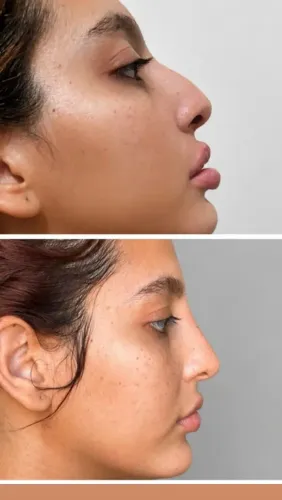 Estetica avançada. Protocolos de botox facial, preenchimento facial, harmonização