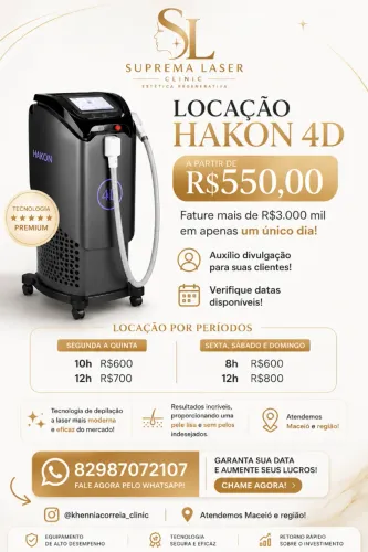 Locação de laser 