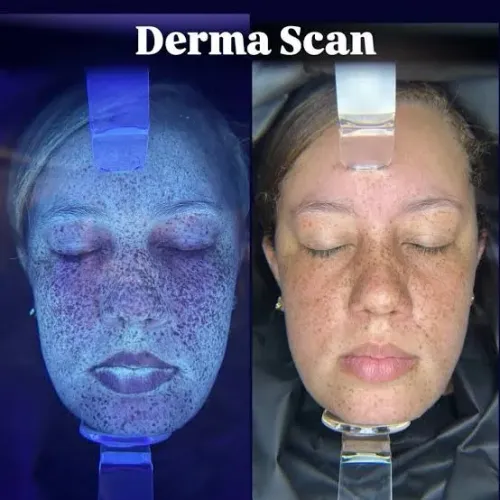 Derma Scan Full Avaliação e Análise da Pele
