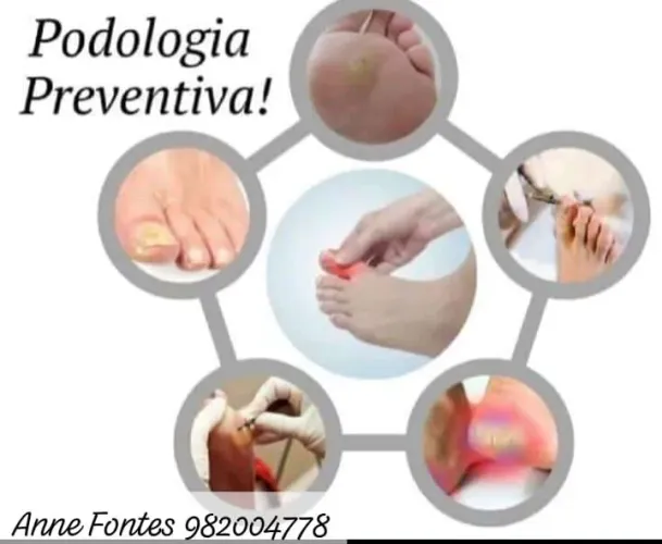 Podologia Preventiva - Cuidados com seus pés!