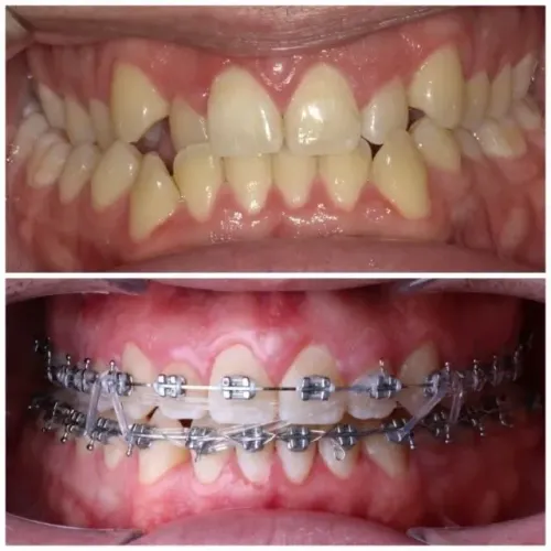 Aparelho odontológico 