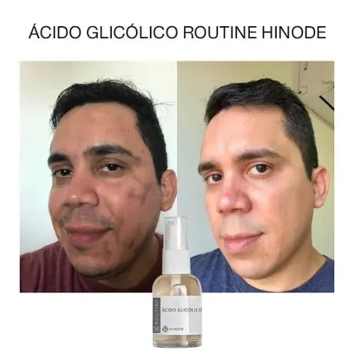 Acido glicolico