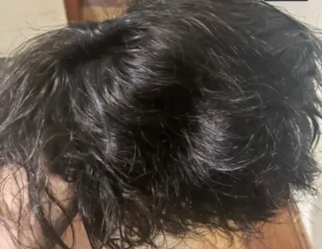 Protese capilar pronta pra uso