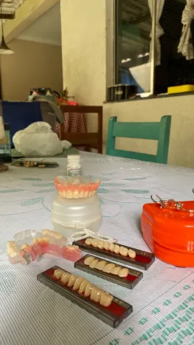 Dentadura ponte móvel roach flexit
