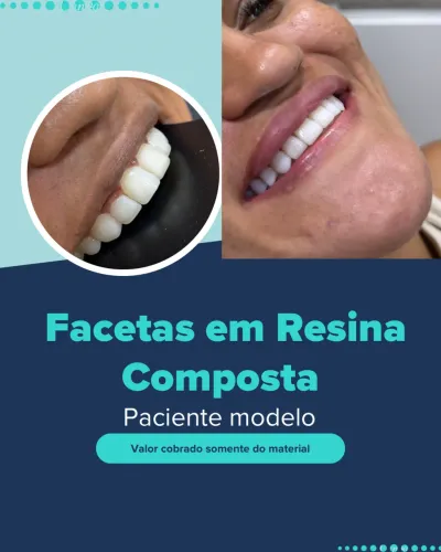 Vagas para paciente modelo FACETAS 