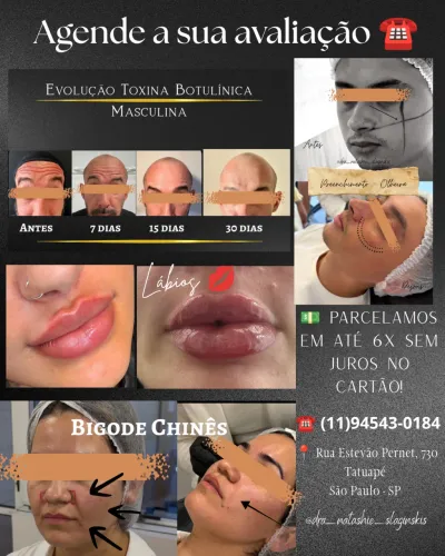 Posicionamento Facial - Harmonização