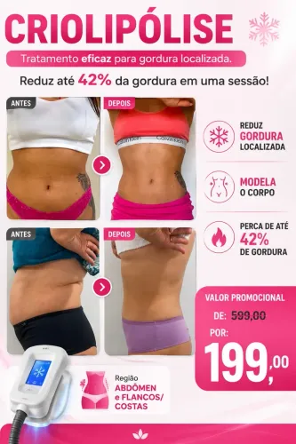 Criolipolise - sessão por área