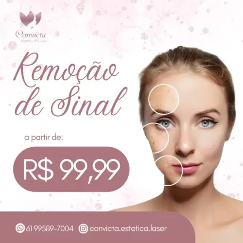 Remoção de Sinal