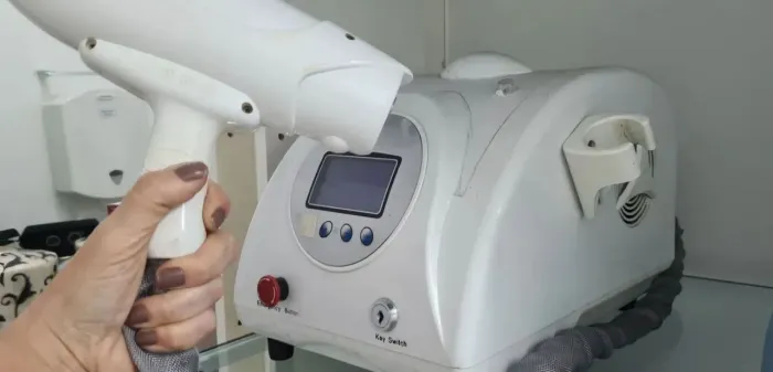 Laser pra remoção de tatuagem - Q Switch Nd Yag