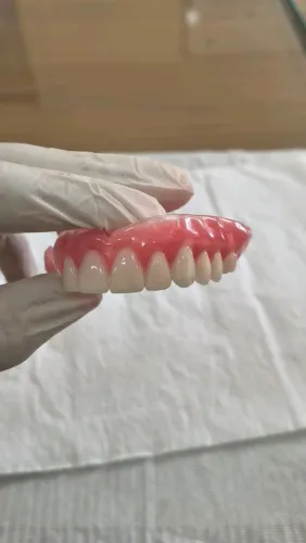 Prótese Dentária de Qualidade - Sorriso Natural e Confortável