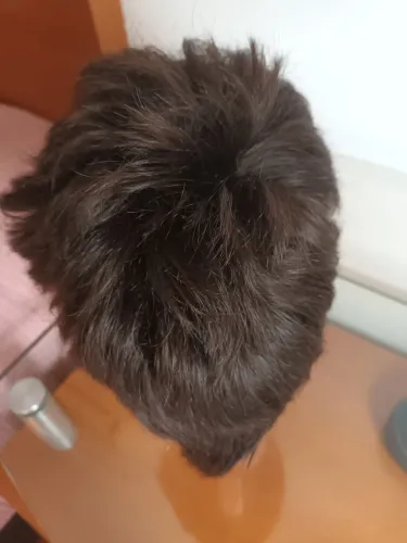 Prótese capilar masculina
