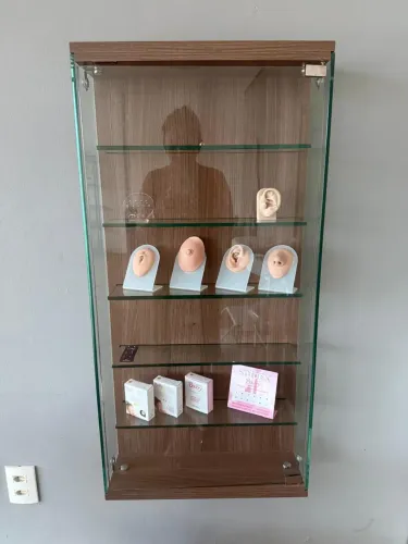 Vitrine 