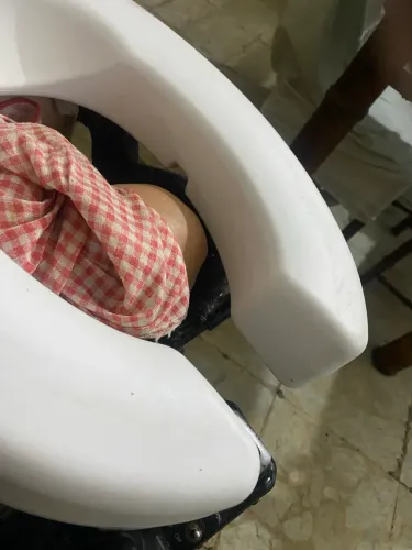 Acento elevado com tampa para idoso e deficiente físico