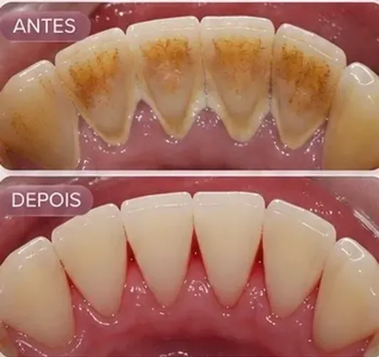DENTISTA PIRACICABA CENTRO