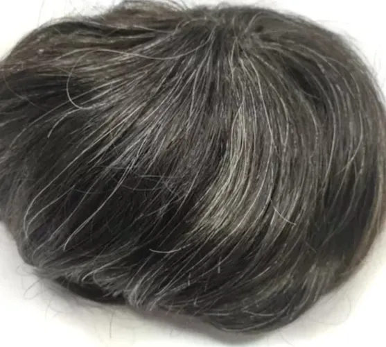 Prótese capilar masculina