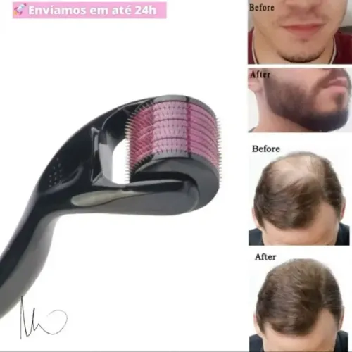 Demarroler