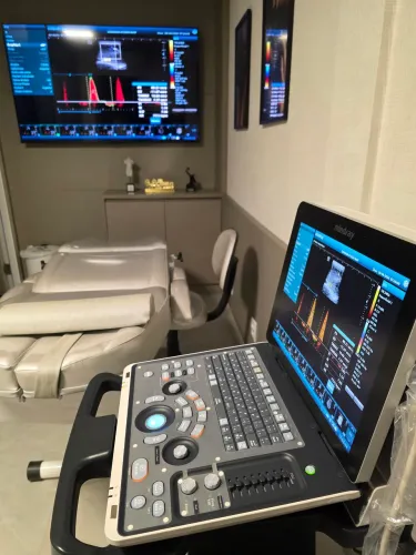 Vendo aparelho de ultrassom portátil Mindray Z50, conservado e em pleno funcionamento.