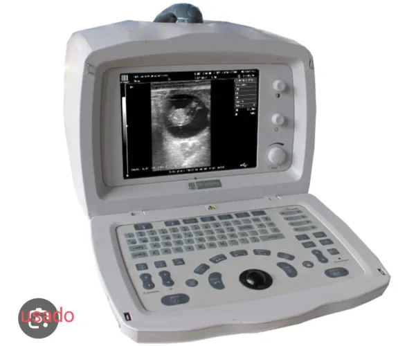 Ultrassom Modelo Mindray DP 2200