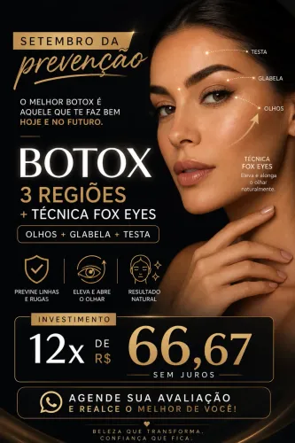 Botox, técnica para levantar olhar