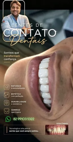 ? PERDEU UM DENTE? PODE SER HORA DE RESOLVER ISSO!