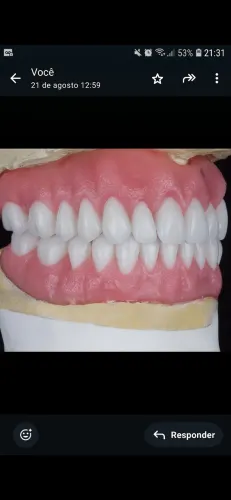 Prótese Dentária F.A