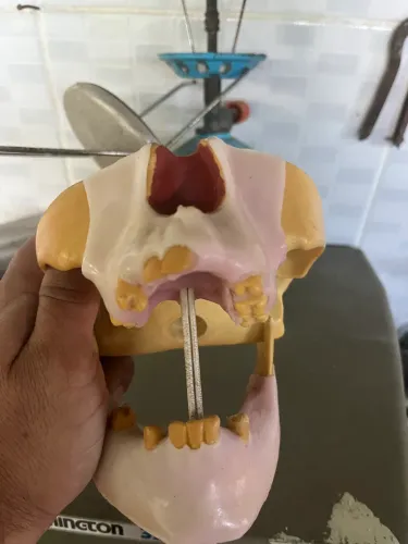 Manequim Pré Molar C/ Gengiva Personalizada