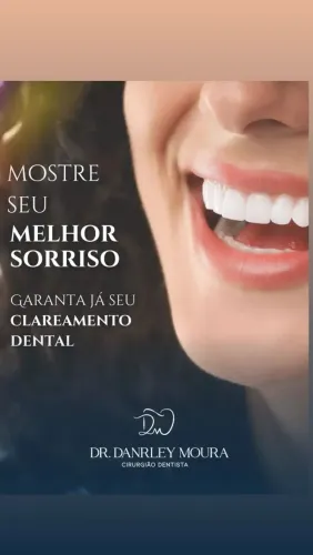 Clareamento dental 