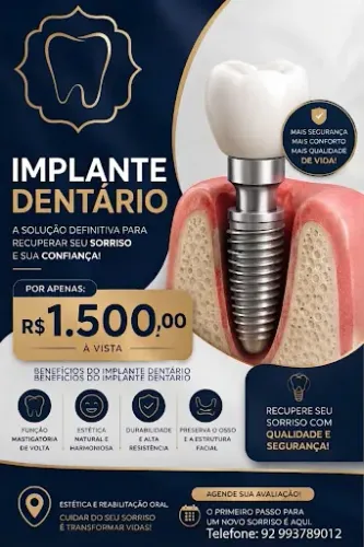 IMPLANTE DENTÁRIO/PRÓTESE