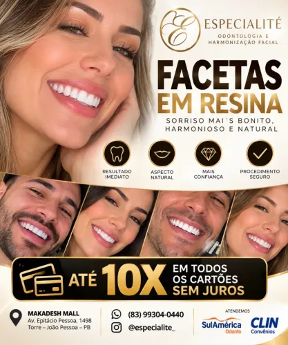 FACETAS EM RESINA | ESPECIALITÉ ODONTOLOGIA | ATÉ 10X SEM JUROS