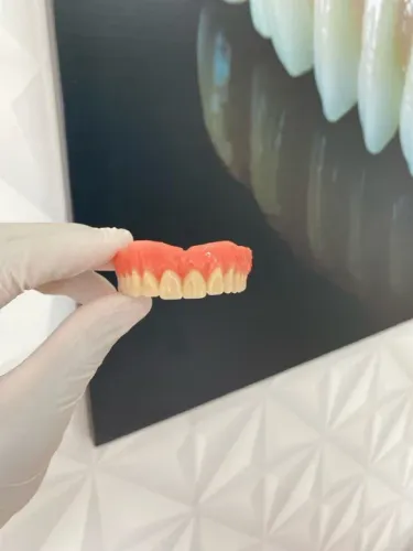 Prótese dentária 