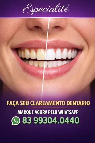 Clareamento Dental em João Pessoa,  Resultado Rápido e Profissional<br>