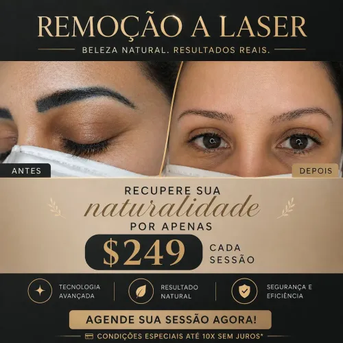 Despigmentação  a laser