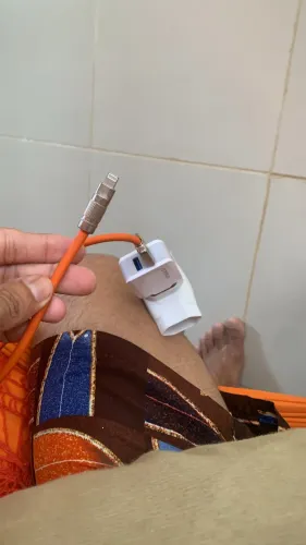 Oi bom dia esse é o iPhone XR ele está na carcaça de um iPhone 17