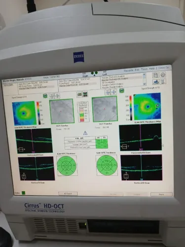 Cirus hd oct