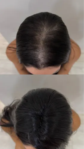 Tela de aplique superior mega hair