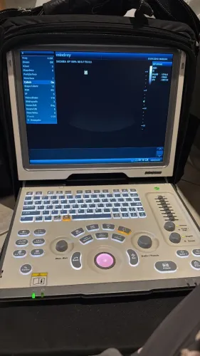 Ultrassom DP-50vet com 4 sondas ultrassonográficas
